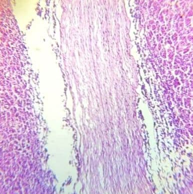 Pituitary gland