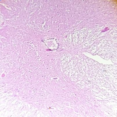 Spinal cord