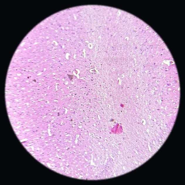 Cerebrum — photographed field 66