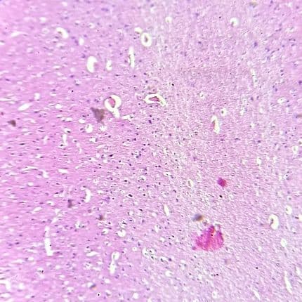 Cerebrum