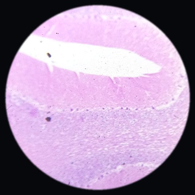 Cerebellum — photographed field 67
