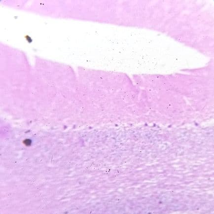 Cerebellum