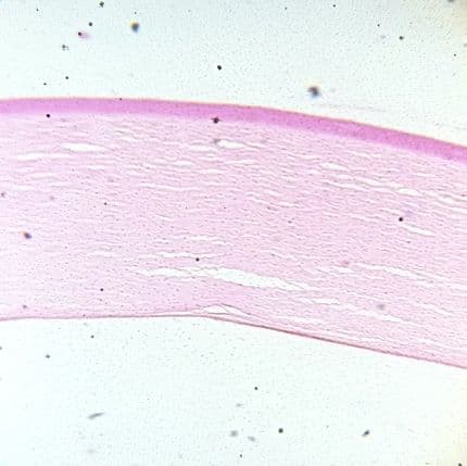 Cornea