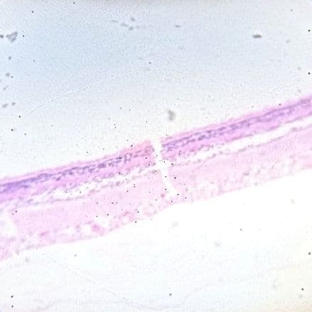 Retina