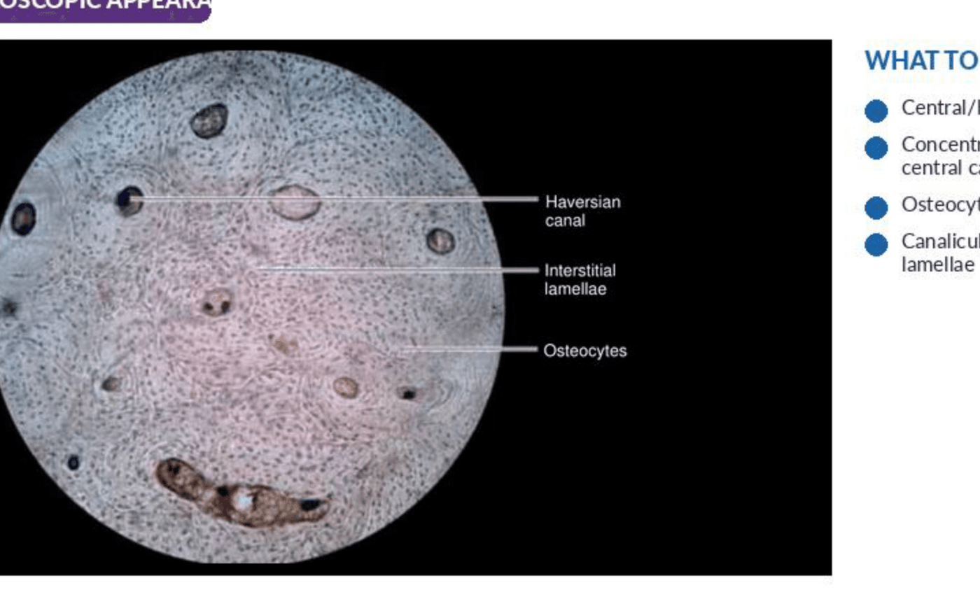 Labelled illustration of Compact bone — transverse section