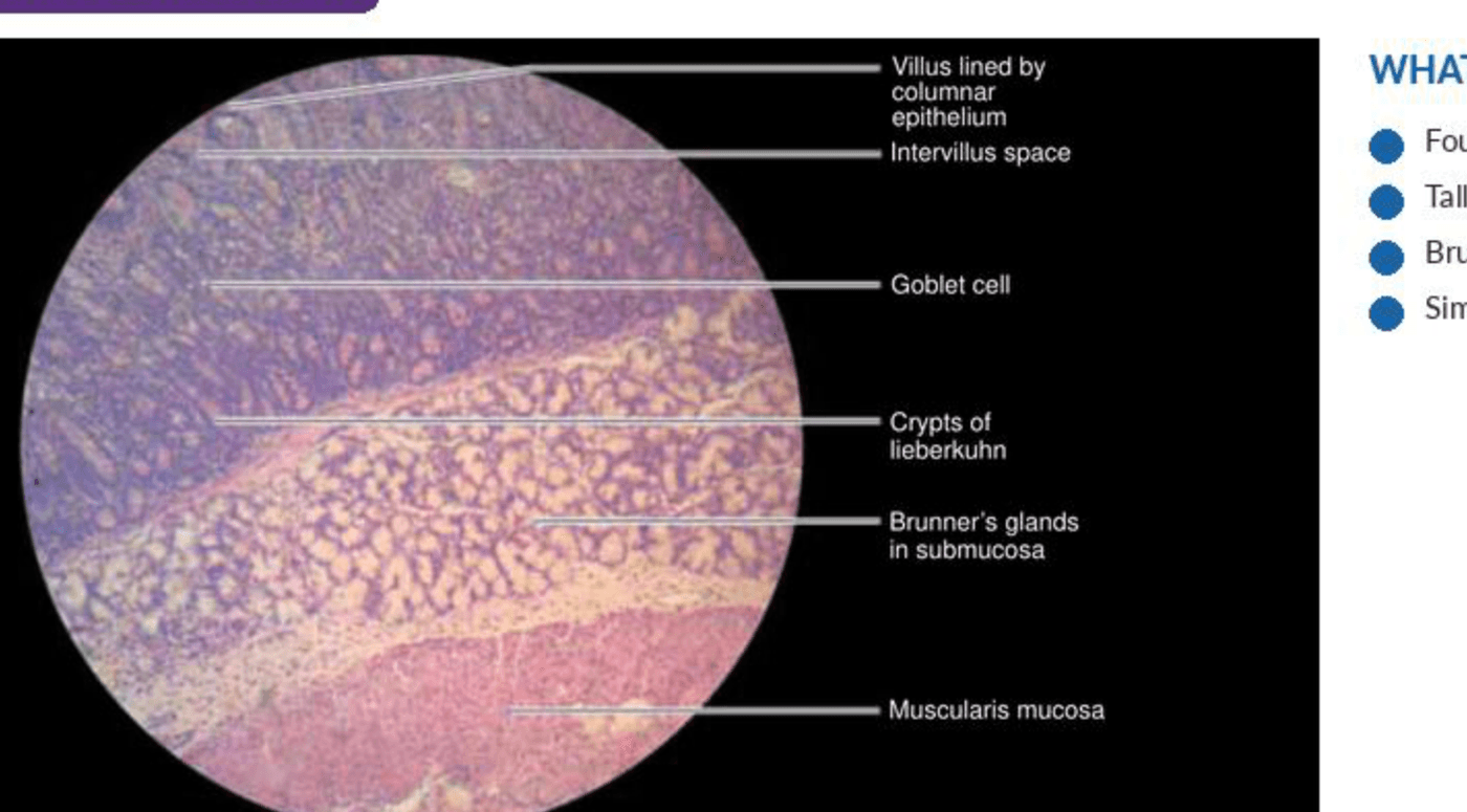 Labelled illustration of Duodenum