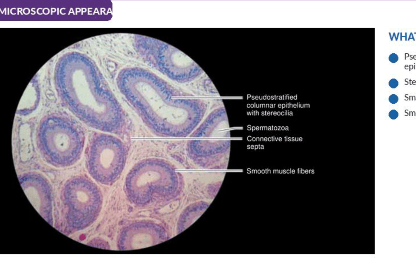 Labelled illustration of Epididymis