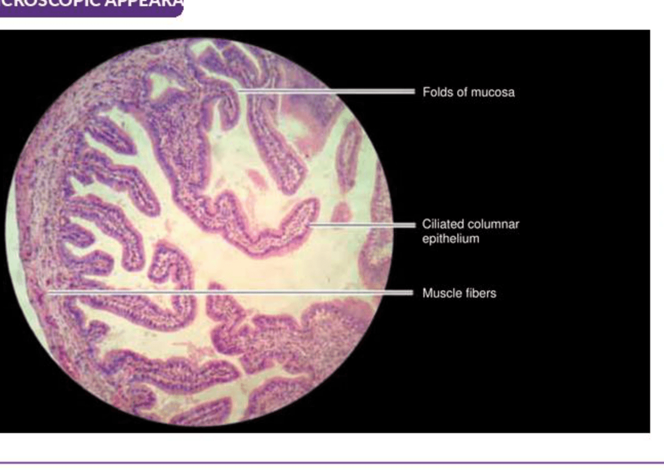 Labelled illustration of Fallopian tube