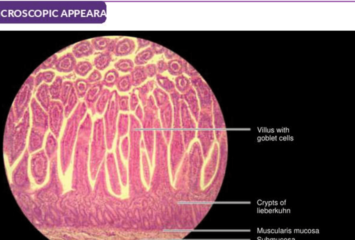 Labelled illustration of Jejunum