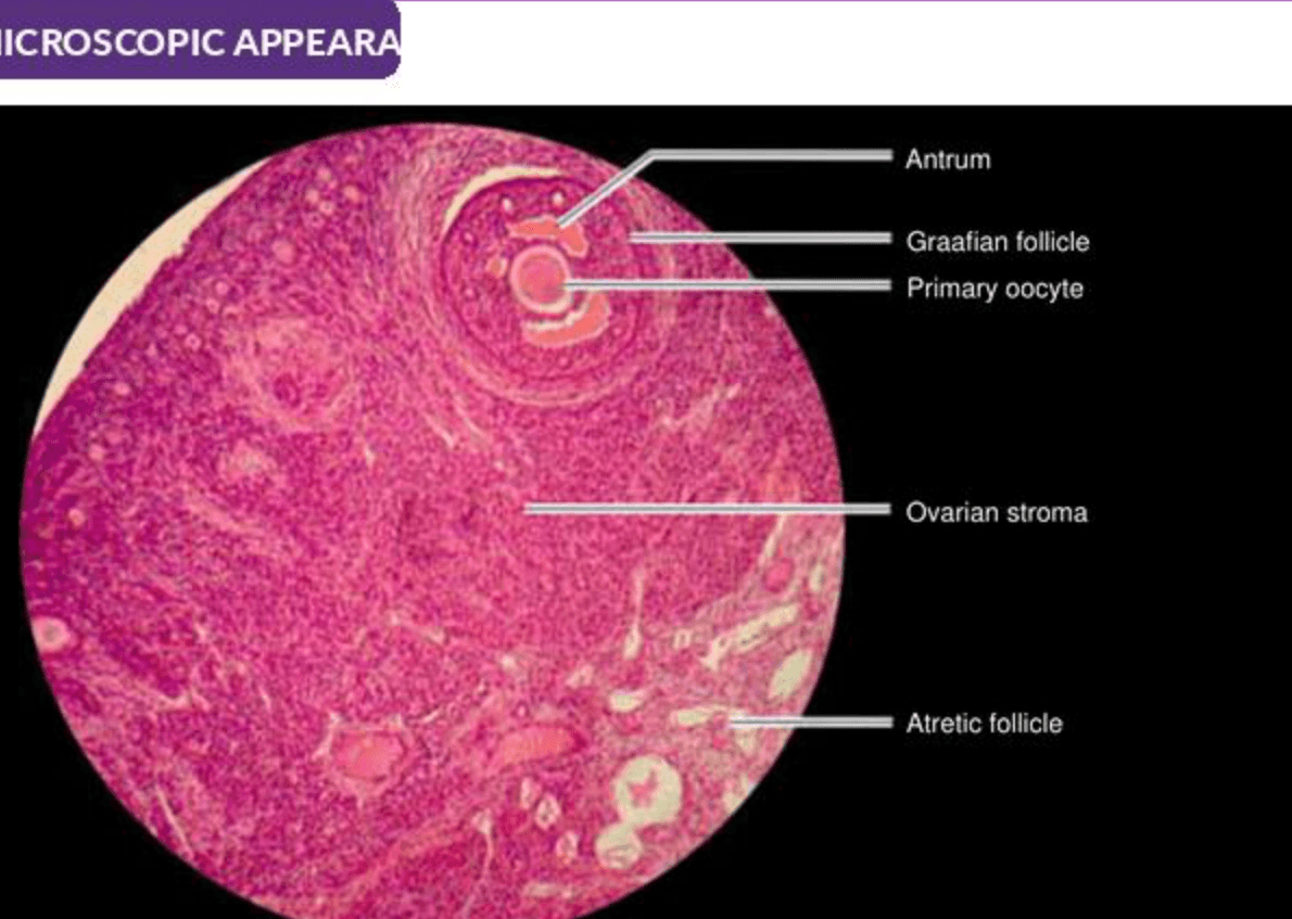 Labelled illustration of Ovary