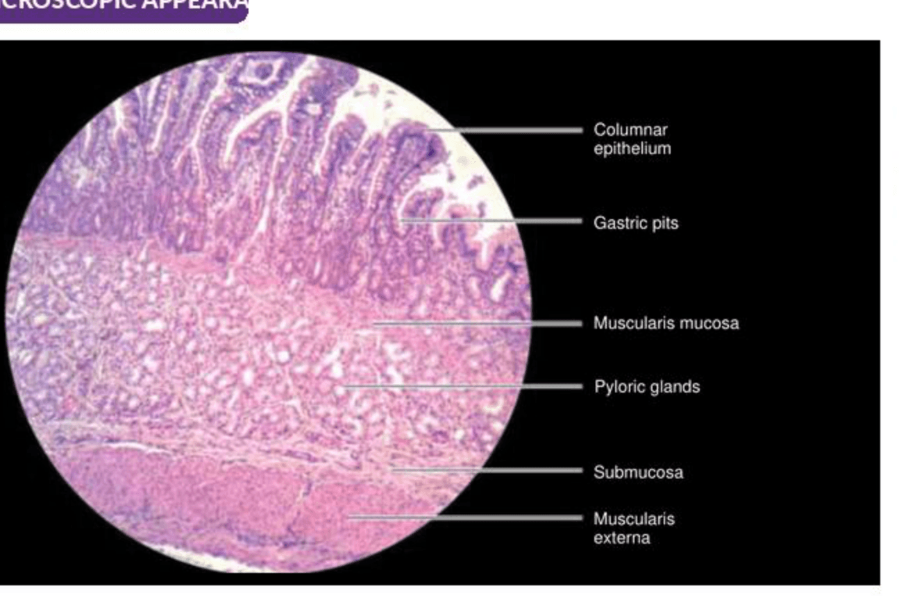 Labelled illustration of Stomach — pylorus