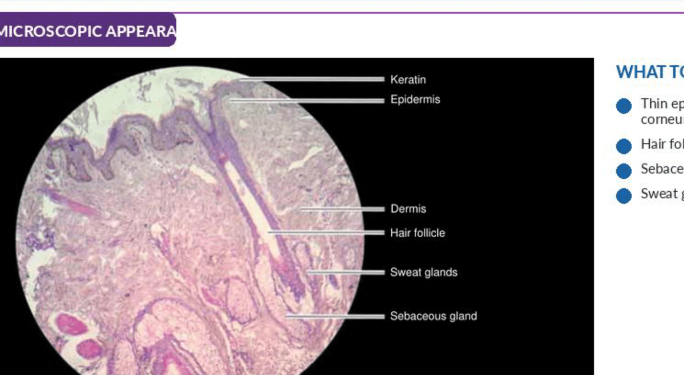 Labelled illustration of Thin skin