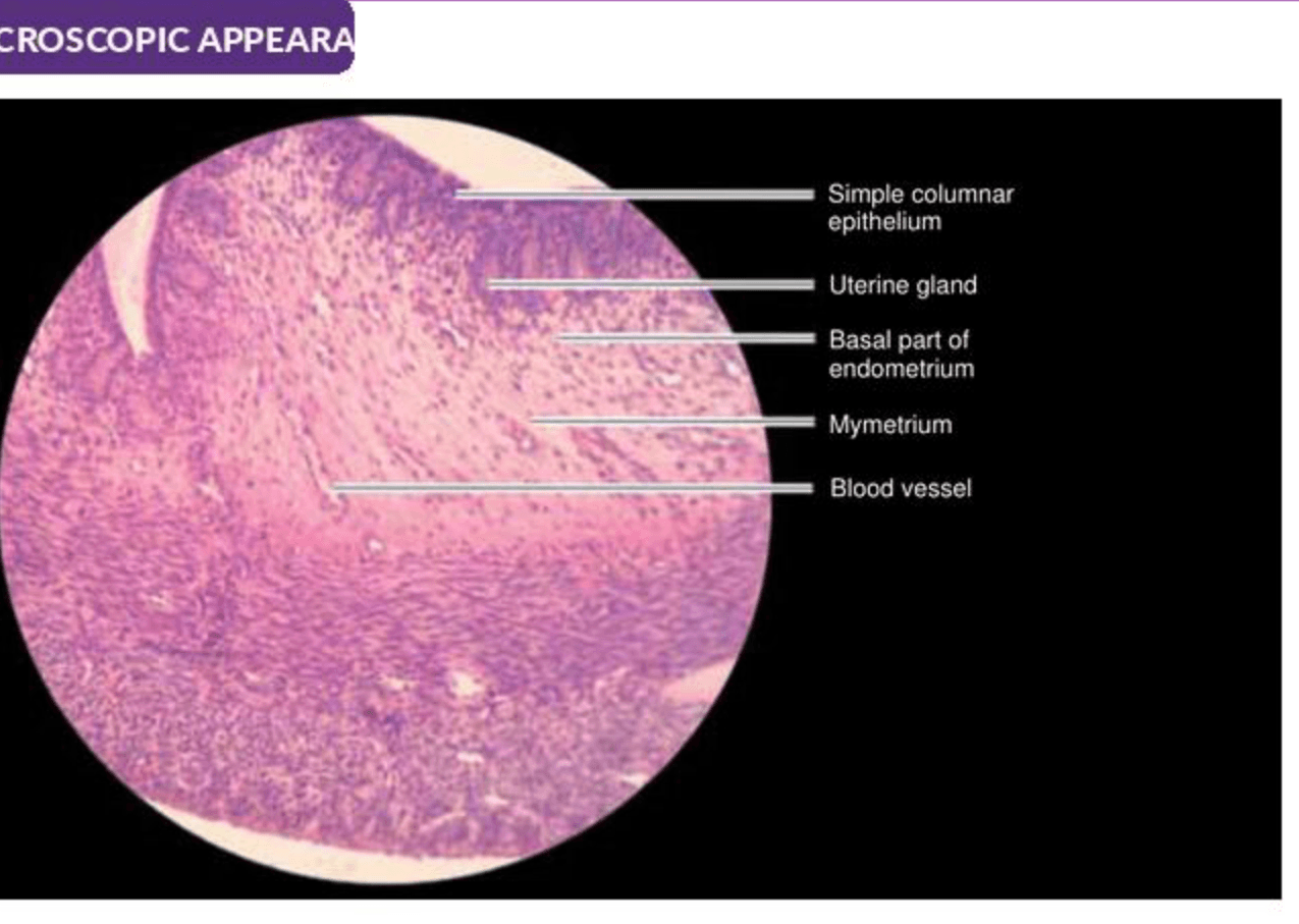 Labelled illustration of Uterus