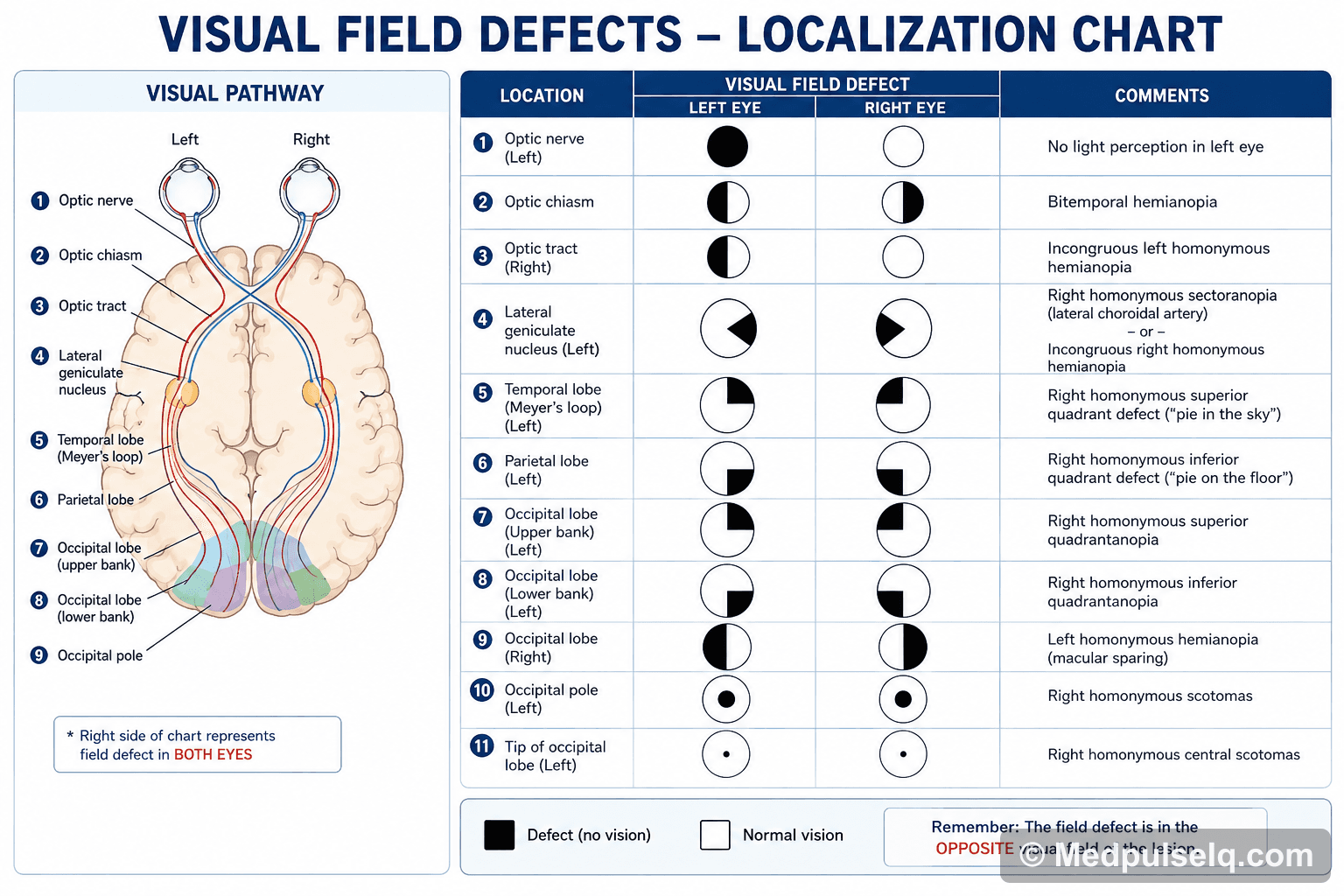 Visual field defects — Ophthalmology