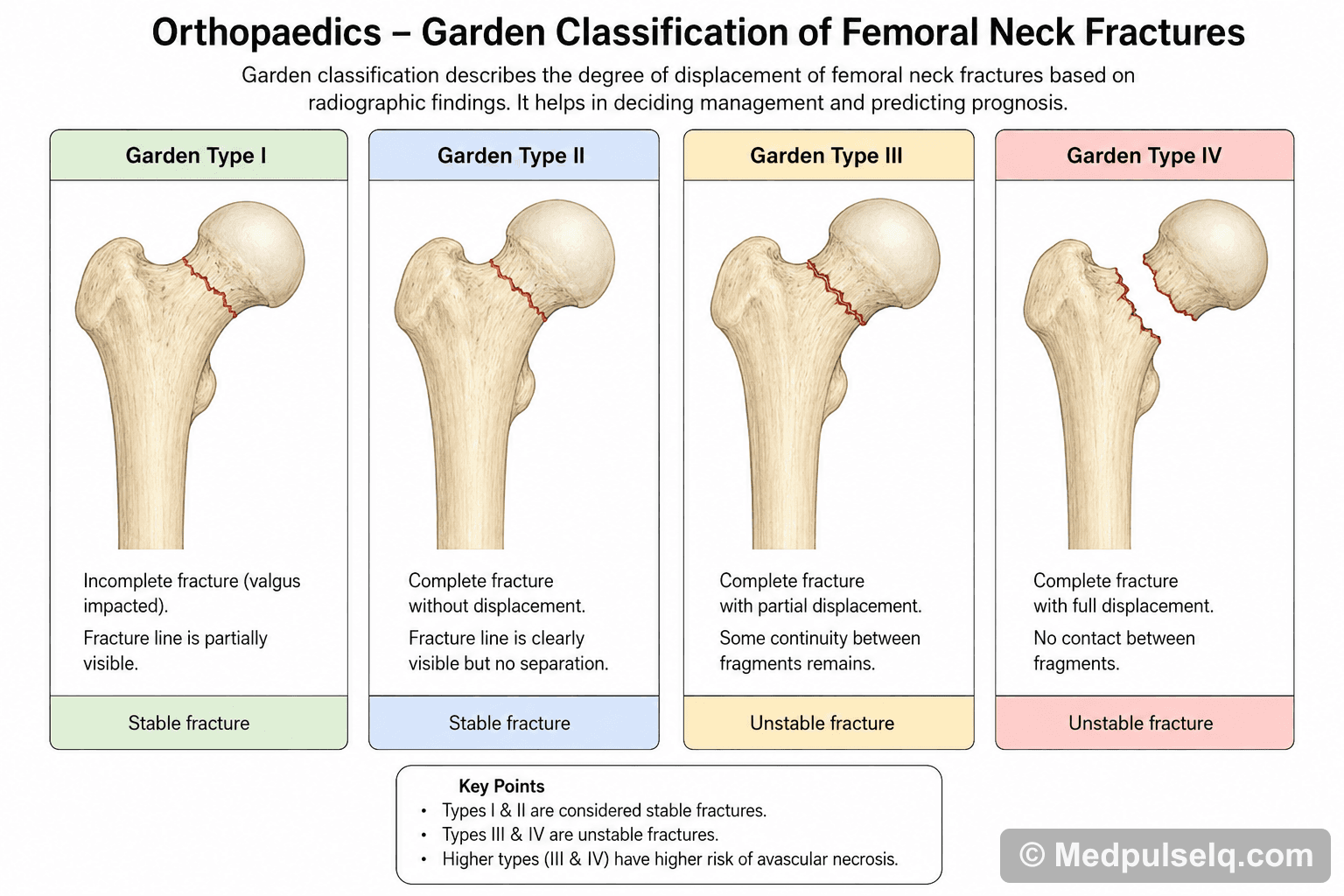 Garden classification — Orthopaedics