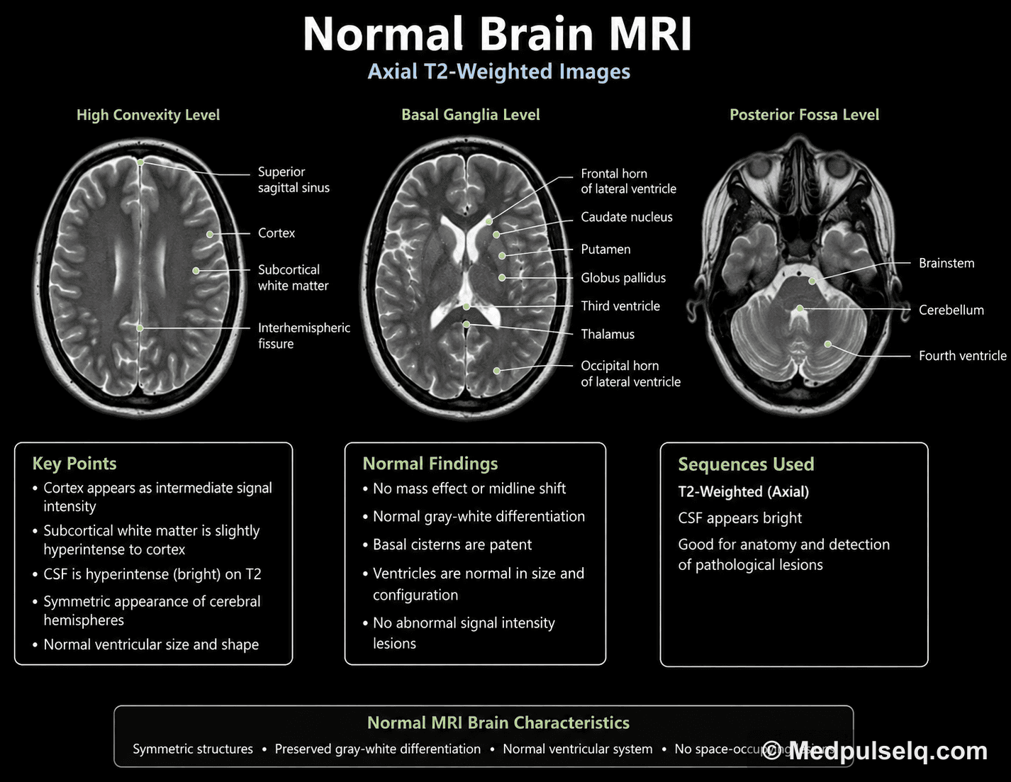 MRI of the brain — Magnetic resonance imaging, Axial section
