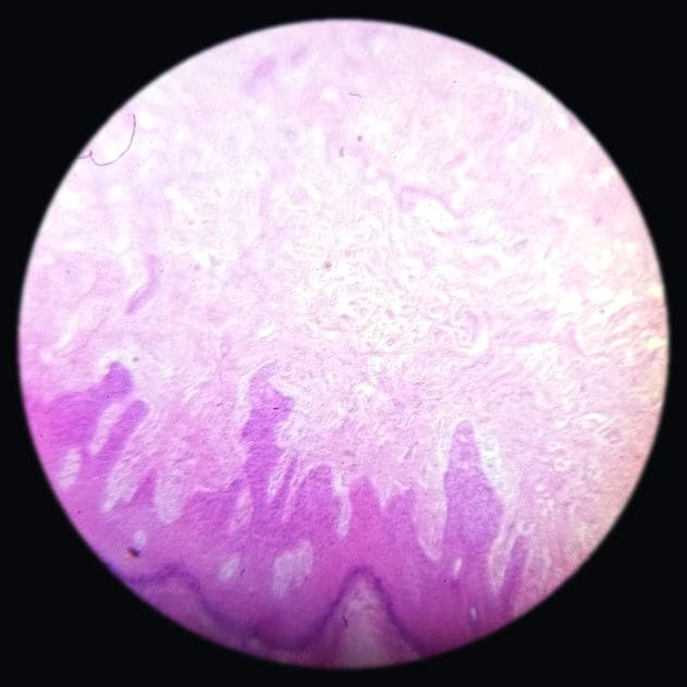 Thick skin — photographed field 2