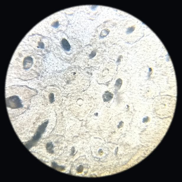 Bone — transverse section — photographed field 7