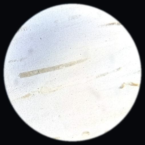 Bone — longitudinal section — photographed field 8