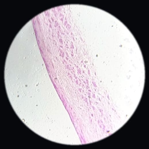 Large vein — photographed field 11