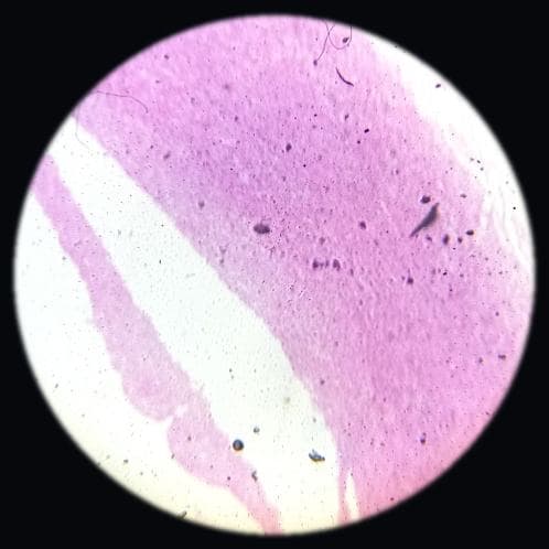 Large artery — photographed field 13
