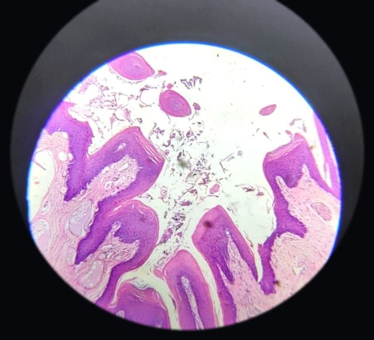 Tongue — fungiform papilla — photographed field 14
