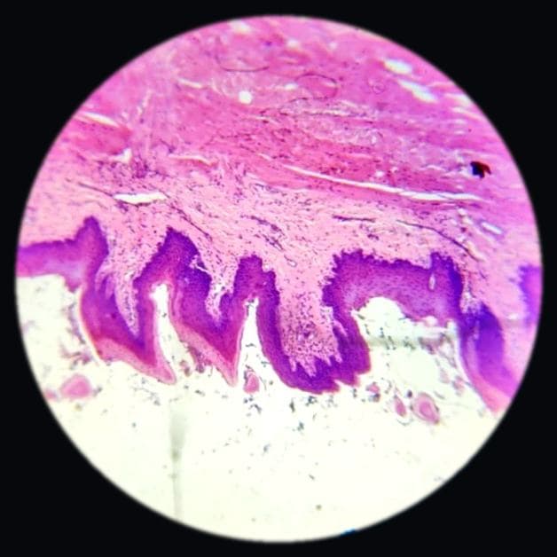 Tongue — filiform papilla — photographed field 17