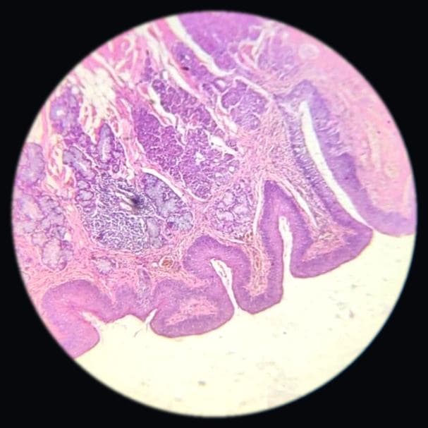 Tongue — circumvallate papilla (CVP) — photographed field 19
