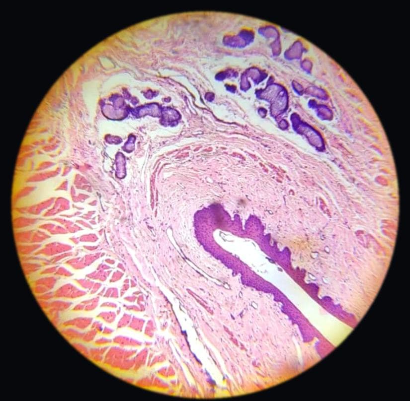 Oesophagus — photographed field 20