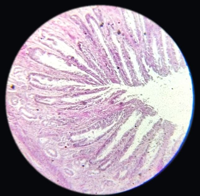 Stomach — pylorus — photographed field 23