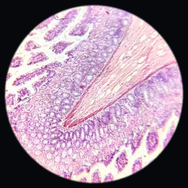 Ileum — photographed field 28