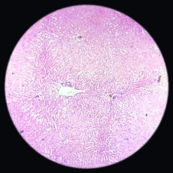 Liver — photographed field 32
