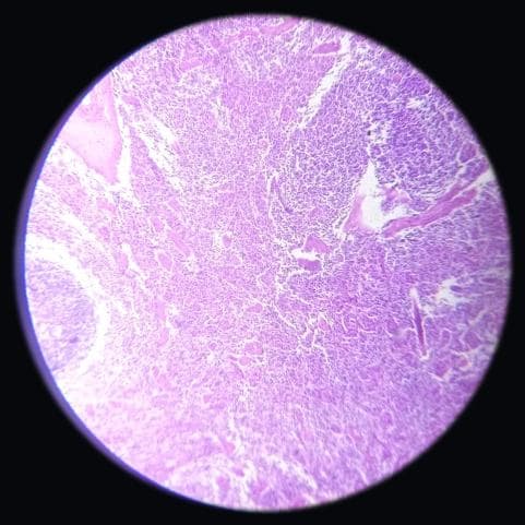 Spleen — photographed field 33