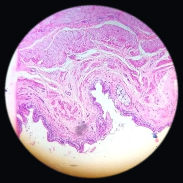 Gallbladder — photographed field 34