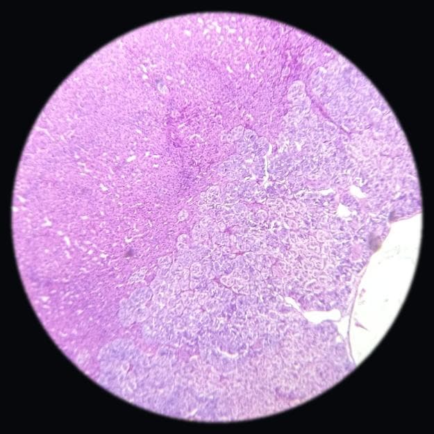 Suprarenal (adrenal) gland — photographed field 36