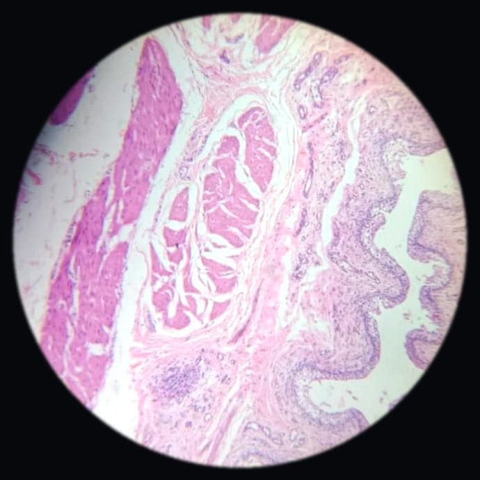 Urinary bladder — photographed field 40