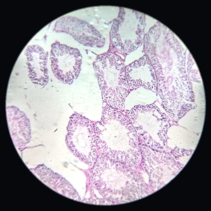 Testis — photographed field 41