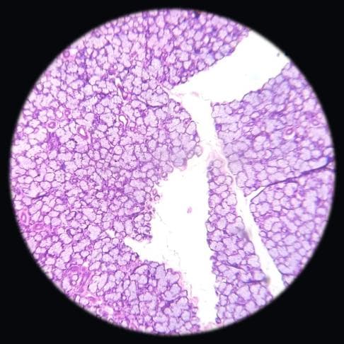 Mucous salivary gland — photographed field 49