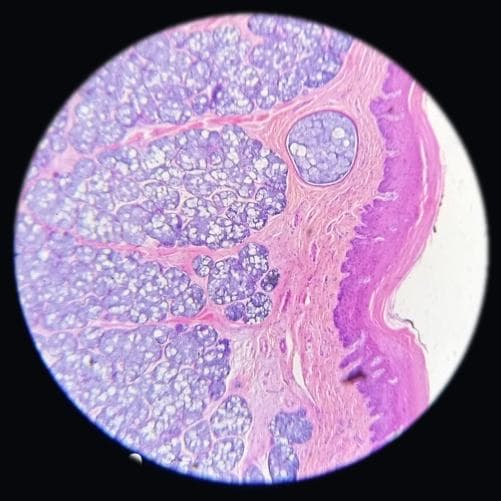 Tonsil — photographed field 52