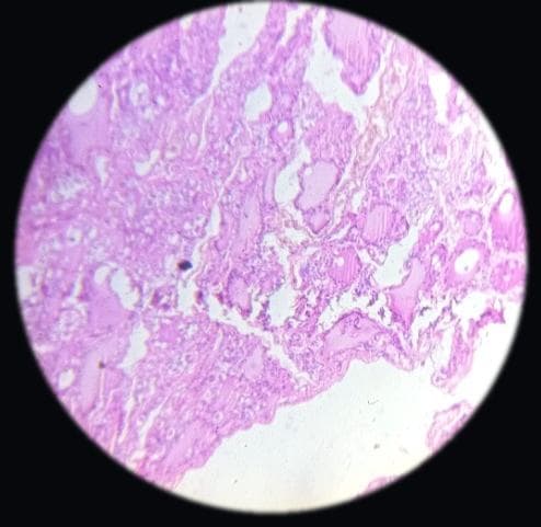 Thyroid gland — photographed field 53
