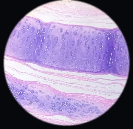 Trachea — photographed field 56