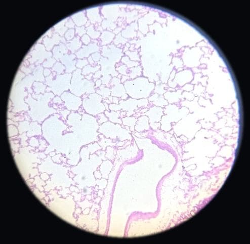 Lung — photographed field 57