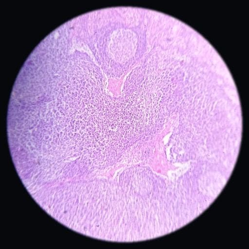 Lymph node — photographed field 58