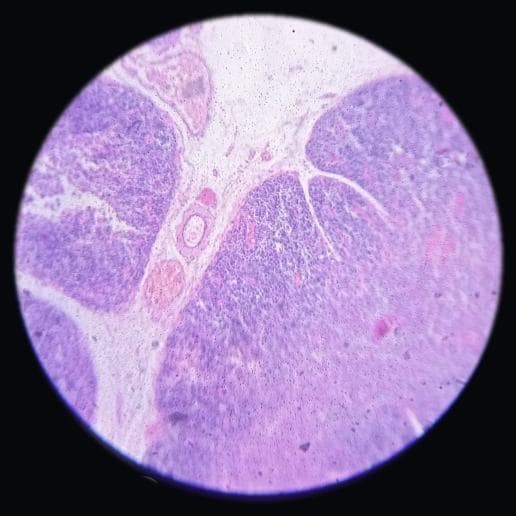 Thymus — photographed field 59