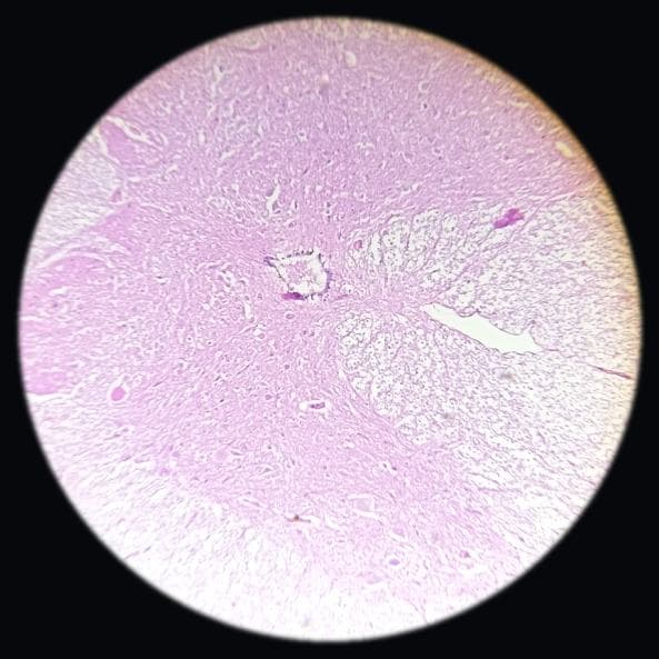 Spinal cord — photographed field 64