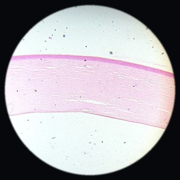 Cornea — photographed field 69