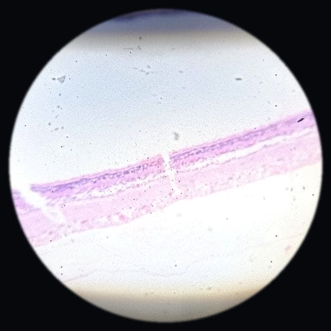 Retina — photographed field 70