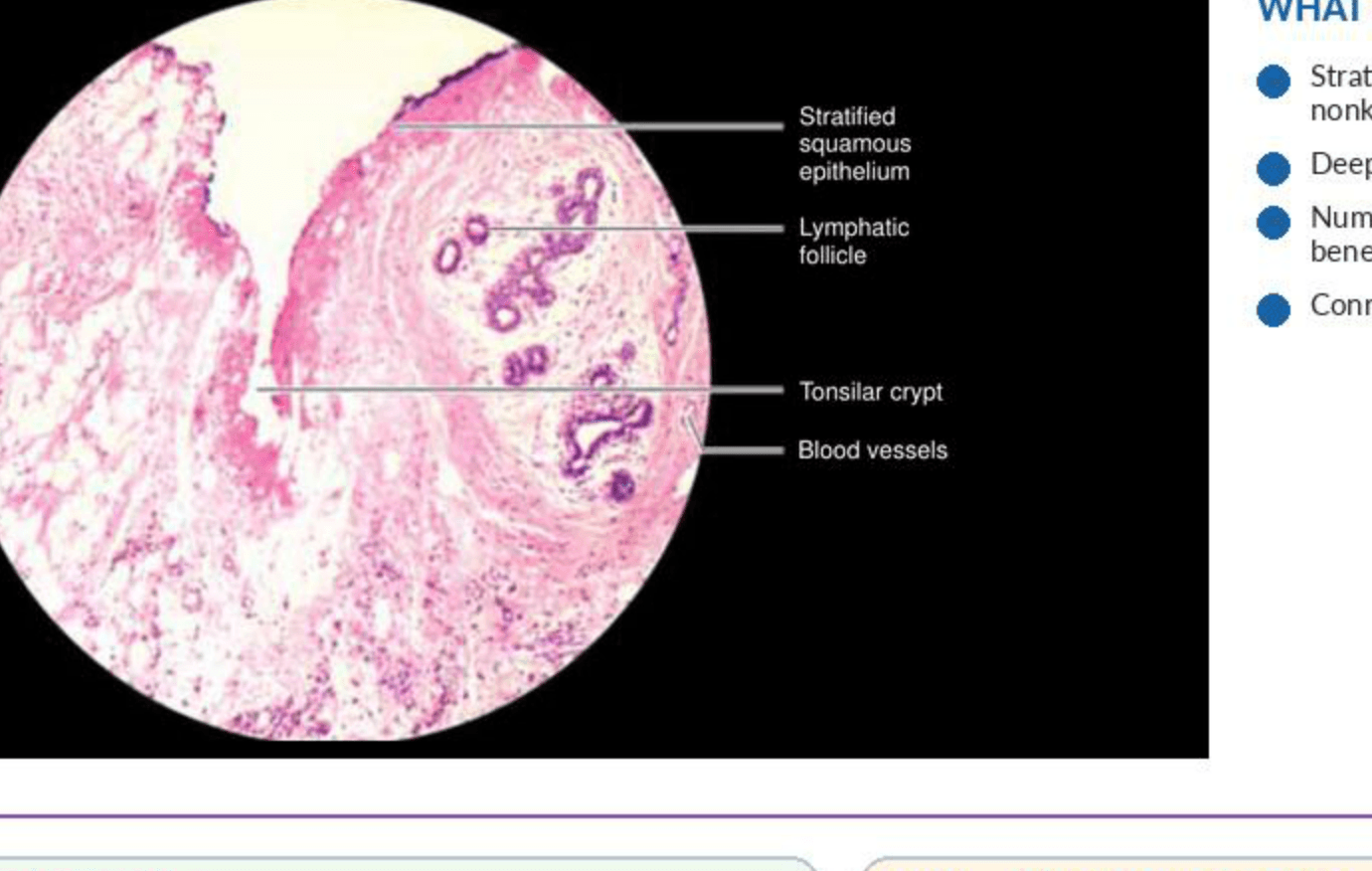 Labelled illustration of Palatine tonsil