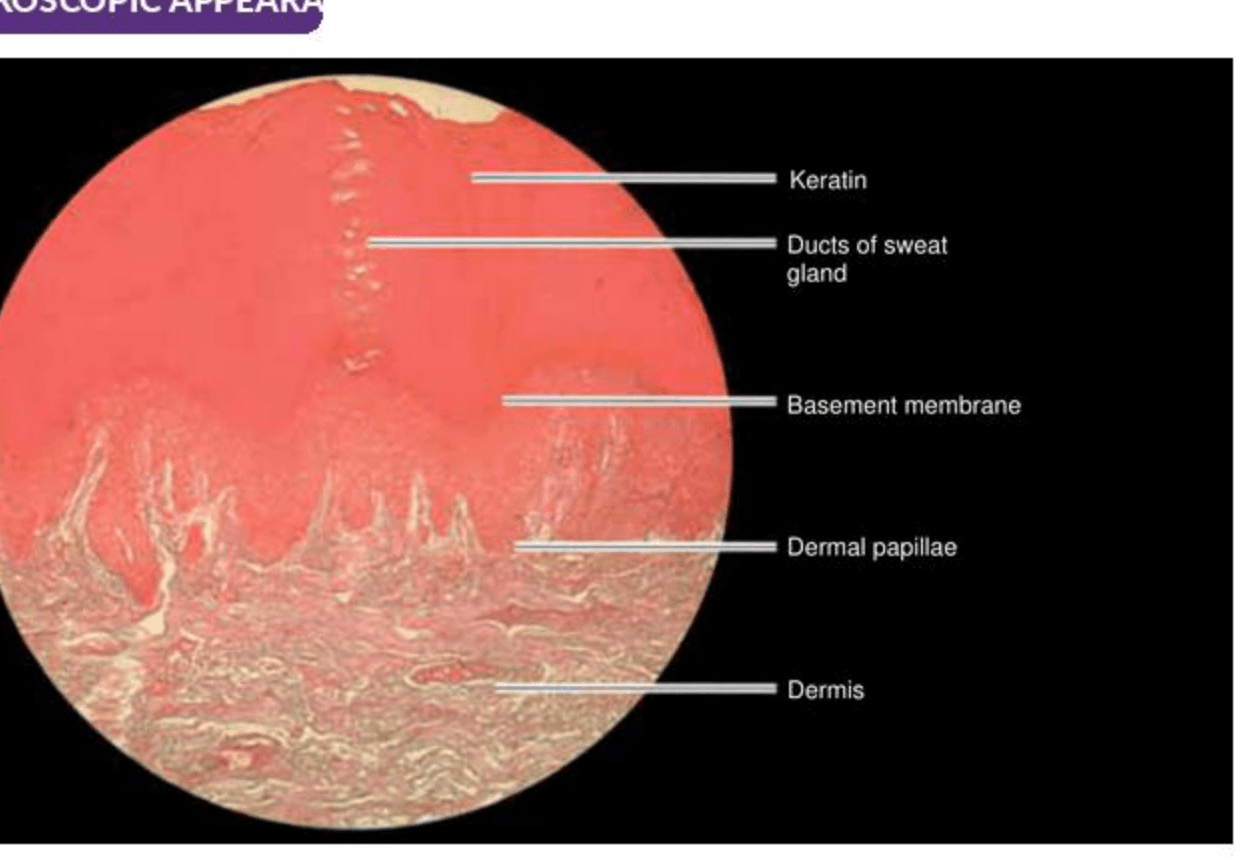 Labelled illustration of Thick skin