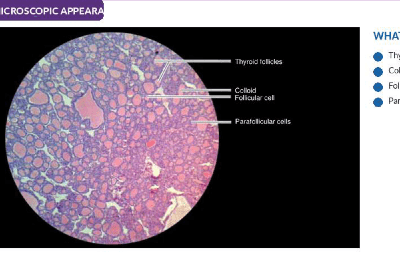 Labelled illustration of Thyroid gland